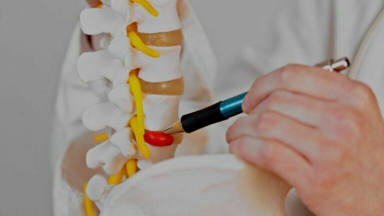 Next Steps When Facet Joint Injections Don’t Work