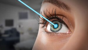 How to decide if it is finally time to ditch glasses and decide to do LASIK