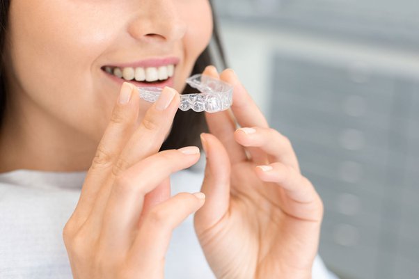 Crooked teeth making you conscious of your smile? Try makeO toothsi clear aligners