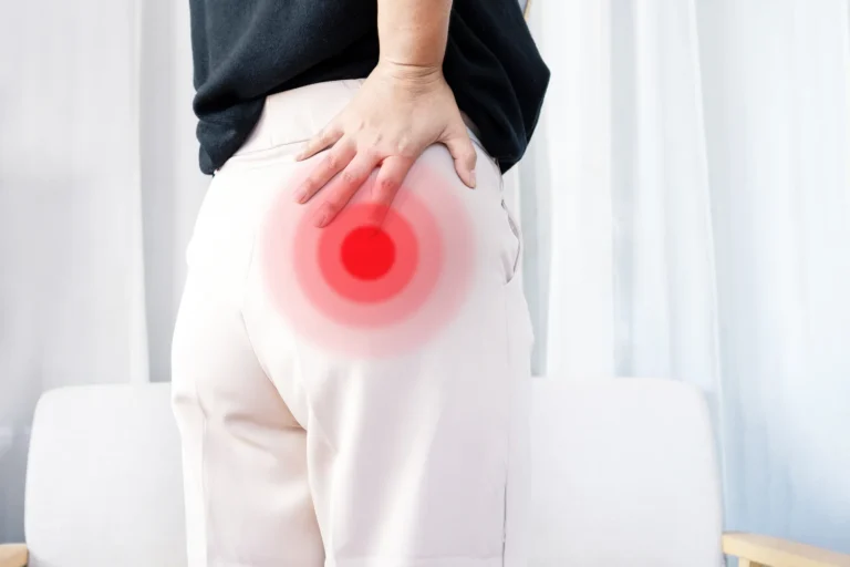 How Long Does Sciatica Pain Last? Timeline, Recovery Stages & When to Seek Help